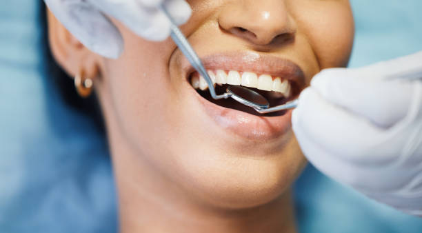 Best Dental Fillings (Composite and Amalgam)  in East Sparta, OH